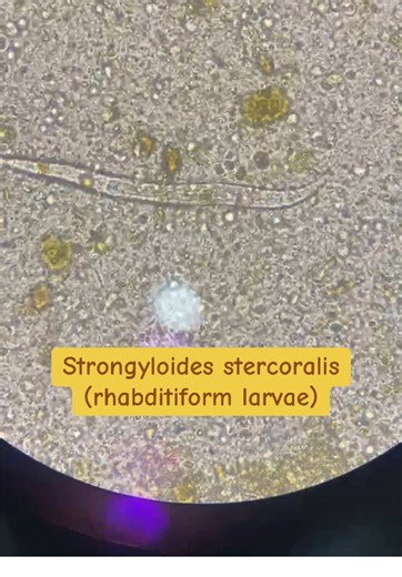 Strongyloides Stercoralis: Rhabditiform Larvae Under Microscope