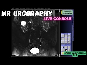 MR Urogram- Live Console Full Tutorial | SIEMENS MRI |