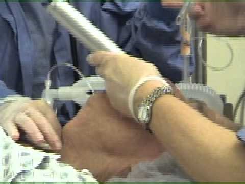 Orotracheal Intubation