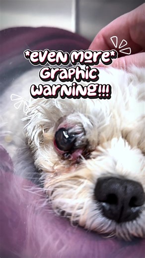 A proptosed eye that can still move? That’s a BIG prognostic clue 👁️ When assessing a proptosis case, I’m immediately thinking about cranial nerve function: 👁 CN III – Oculomotor nerve 👁 CN IV – Trochlear nerve 👁 CN VI – Abducens nerve If the globe can still move, those extraocular muscles — and the nerves supplying them — may still be intact. And that significantly improves the likelihood of visual and cosmetic salvage. No movement? I’m much more concerned about: • Severe extraocular muscle