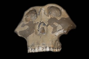 Wie der Herpes auf unsere Genitalien gelangte