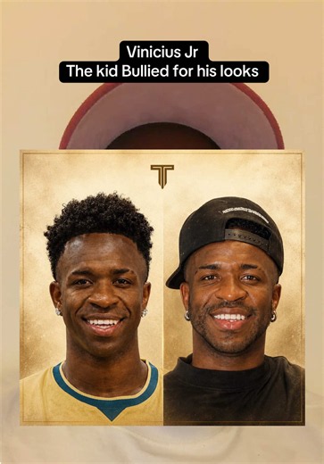Man this Vini chin harmonisation news makes me sad, feels like he was bullied into it. He was constantly mocked for his looks. By team mates, by racists, and by online creators depicting edited versions of himself saying he would look much better with European features. All of that can really mess with the mind of a young black boy. I feel it created a level of self hate and low self esteem. #vinijr #chinharmonization #brasil #racism #vinijr🇧🇷