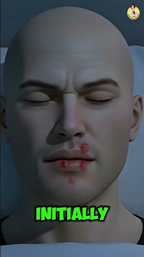 Kissing Bug Bite Explained by a Doctor 👨‍⚕️ | Causes, Symptoms, Treatment & Prevention