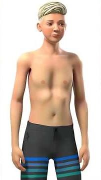 How Doctors Fix a Sunken Chest (Pectus Excavatum)