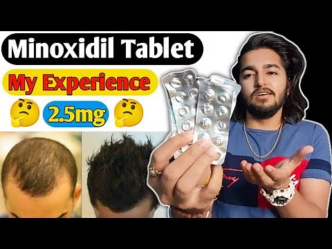 Minoxidil Tablet Experience | Lonitab 2.5mg Minoxidil Tablet