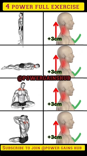 Neck Alignment Fix — Unlock a Stronger Posture!