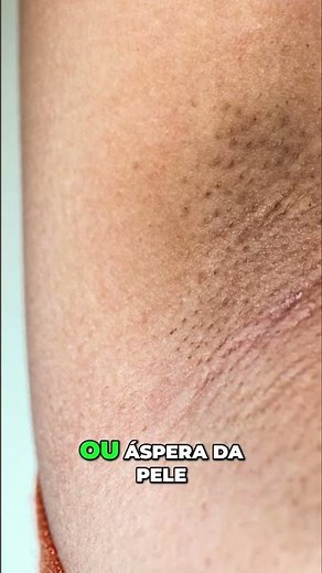 Dark underarms, what could it be?
