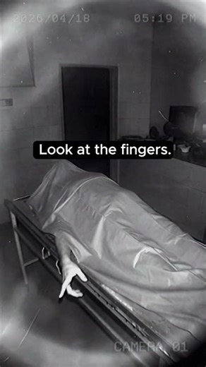 Real Medical Anomaly or Ghost? Corpse Hand Moves 😨