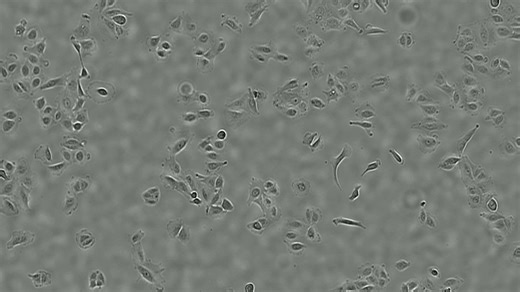 Celloger活细胞成像仪拍摄细胞增殖