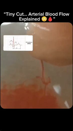 “Tiny Cut… Arterial Blood Flow Explained 😳🩸” #blood #flow #heart #shorts #trending #viral