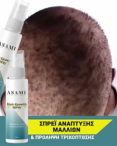 ASAMI Hair Products on Instagram: "Asami - ένα πατενταρισμένο προϊόν κατά της κληρονομικής τριχόπτωσης. Με κλινικά αποδεδειγμένα αποτελέσματα. Τώρα με 50% έκπτωση. Οι πιθανότητές σου για νέα μαλλιά 👉 https://bit.ly/3jBgsno 👈 👉 ΠΑΡΑΓΓΕΙΛΕ ΕΔΩ 👈"
