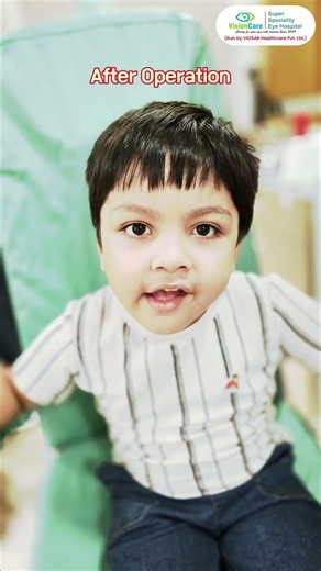 Exotropia—A form of strabismus