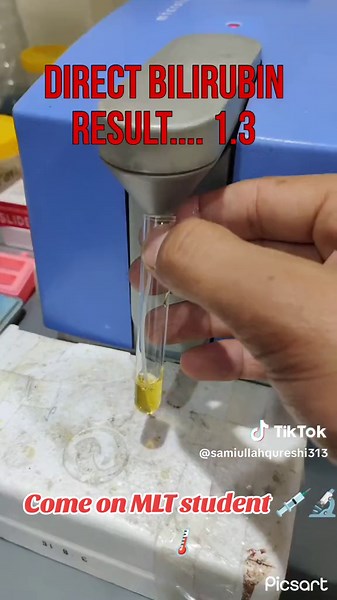 Bilirubin Direct indirect Test Procedure in Microlab 300 ...🏥 #trendingvideo #meficalstudent💉🌡️💊 #medicalstudent #mltstudent #followers😘thanku #viral?videotiktok😇😇 #medicalstudent #hospitallife #gilgitbaltistan✌🏽😍 #underreviewproblem😣 @Australia @Ukraine @Australia Medical Center Dubai @Muنeeba @Dr.🩺Fawad 💊 @예지 Yeaji @❣️ صحابہ کی دیوانی ❣️ @MLT 🔬🧪🧫