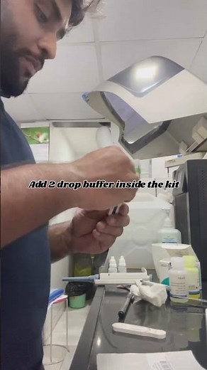 How to process the D dimer test #viralvideo #doctor #viralvideo #doctor #youtubeshorts #familyvlog