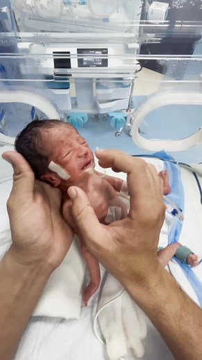 1.3M views · 5.2K reactions | #cutebaby #baby #babyfirstbreath #cute | Born Cute Babies | Facebook