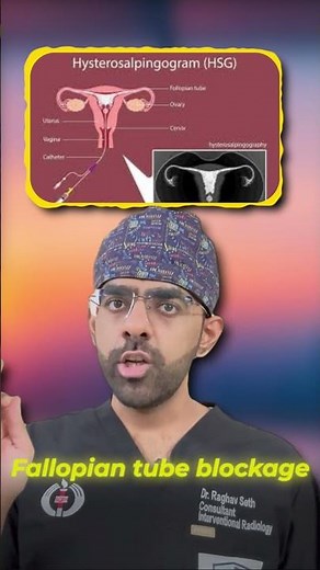 Treatment For Fallopian Tube Blockage | DO YOU NEED IT? EXPLAINED IN DETAIL #fallopiantubeblockage