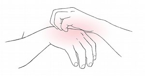 Download Have a itching, Concept with Healthcare And Medicine, 2D Animation for free