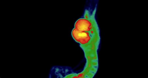 The Surprising Power of a Bird Brain