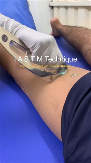 MyoCare Physio | ✨ IASTM for Hamstrings & Calves ✨ Instrument-assisted soft tissue mobilization helps reduce adhesions, improve circulation, and restore... | Instagram