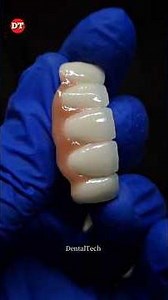 Anterior Ceramic Process| dental lab| dental video| anterior Ceramic Porcelain| posterior| build up