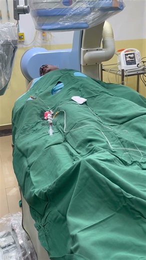 LIVE CATH LAB ANGIOGRAM ://: #hospital #cardiology #doctor #cathlab #medicalline #cathlabtechnician