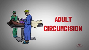 Adult Circumcision