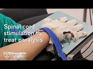 Spinal cord research helps paralysed hand to move again