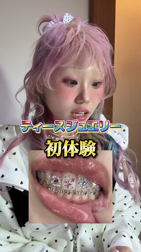 in韓国‼️🇰🇷 みたいになってるけどw 韓国の方が日本でPOPUPをやっていたので初めてのティースジュエリー行ってみた✨️⟡.* ティースジュエリーめちゃくちゃ可愛くない！？！？ ずっとやってみたかったんだけどやってみたらこんなに可愛いなんてびっくり❣️❣️❣️ ずっと鏡見ちゃう、、キラキラ반짝반짝ちょ〜귀여운🩷💓💞💓💞 ぐるぐるデザインとさくらんぼちゃんがののちデザインで他の歯はおまかせにしたの〜🌟🍥🍥 歯までかわいくなってテンション爆アゲロック⚡️⤴︎⤴︎⤴︎ #ティースジュエリー #韓国 #体験 #toothgem