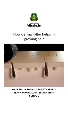 BIOLOGY | MEDICAL | HEALTH on Instagram: "Derma Roller for Hair Growth: How It Works & PRP BenefitsA derma roller helps hair growth by creating tiny micro-injuries on the scalp, which triggers the body’s natural healing response. This process increases blood circulation, boosts collagen production, and may activate dormant hair follicles, leading to stronger, healthier hair and potentially new growth. The micro-channels created can also enhance the effectiveness of topical hair growth treatment 