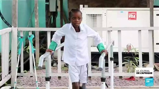 RD Congo : pour les patients amputés, des prothèses fabriquées grâce à la 3D