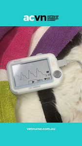 Pulse Oximeter's can be hand held devices as seen here, or as part of a multi parameter machine. They are a very helpful diagnostic tool for any sedated, anaesthetised or critical care patients where cardiovascular and respiratory assessment is needed. #vettech #vetmed #vetnursing #veterinarycare #pets #tipsandtricks #PetCare #student #studentlife #criticalcarenursing #vetclinic #vetcare #vetnursewebinars #veterinarymedicine #surgicalnursing #veterinarytechnician #vetnursestudent #veterinarynurs