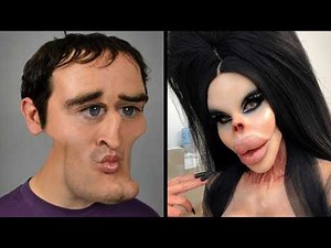 These Plastic Surgery Procedures Went Wrong: The Most Shocking Transformations Ever