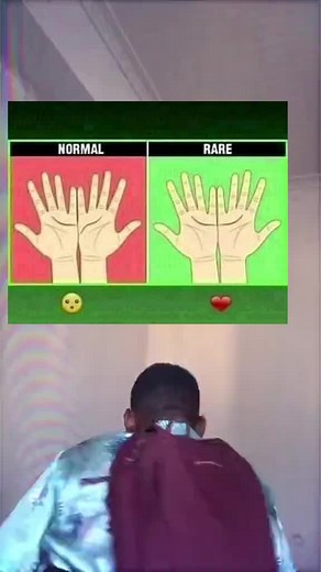 Normal ou rare: La beauté des différences