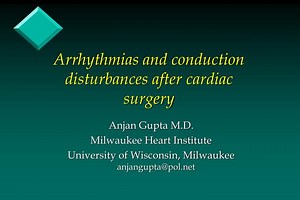 Arrhythmias and conduction disturbances after cardiac surgery - SlideServe