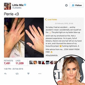 Ouch! Perrie Edwards Accidentally Set Her Hand on Fire: It Was a ''F--king Nightmare''