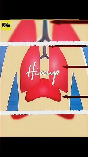 Why Do We Get Hiccups?🤔 Surprising Causes Explained & Simple Ways to Stop Them#shorts