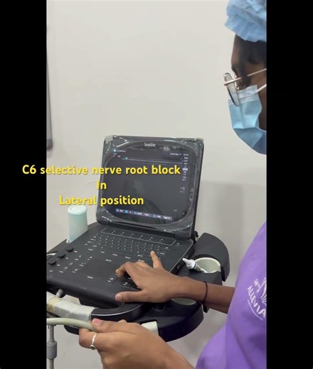 C6 selective nerve root block in lateral position