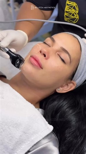 BELLEZZA AESTHETICS PHILIPPINES on Instagram: "Did you know? Not All “Contouring Facials” are the same. 💁🏼‍♀️ Basic RF devices give nothing but temporary results. Here at Bellezza, our Snatched Facial is powered by InMode Pro, a multi-million peso investment + medical-grade protocols for actual tissue remodeling The difference? Cheap RF heats your skin blindly. Snatched Facial has built-in temperature sensors that auto-adjust in real-time, maintaining the exact 39-43°C proven to trigger collag
