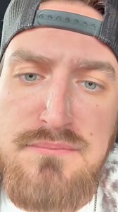 Proven to open your nose 2x wider than the average nasal strip, Intake Breathing is a revolutionary nasal dilator designed to transform your breathing experience. Don't be one of the 2/3 of people who live with the difficulty of breathing through their nose. Whether it's for your workout routine or just sleeping, experience a gateway to enhanced health and vitality. | Intake Breathing