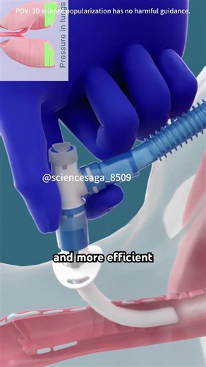 Tracheotomy Procedure (3D Animation)#Tracheotomy #Tracheostomy #TracheaOpening