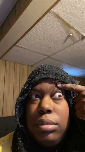 Eye Blink Challenge: Can You Close One Eye While Holding the Other Open?#EyeChallenge