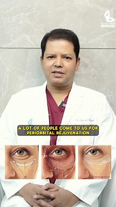 ✨ Brighten & Refresh Your Eyes! Dr. Iqbal Ahmed explains Periorbital Rejuvenation—the ultimate solution for: ✅ Dark Circles & Eye Bags – Restore a youthful, well-rested look. ✅ Fine Lines & Wrinkles – Smooth out aging signs around the eyes. ✅ Hollow & Sunken Eyes – Replenish lost volume for a fresh, vibrant glow. ✅ Safe & Effective Treatments – Tailored solutions for a natural, lasting result. 💡 Rejuvenate your eyes, enhance your confidence! 📞 Call Now: 01766-935254 | 01314-099922 #Periorbital