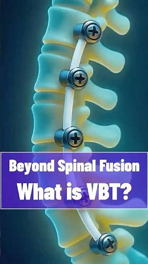 Beyond Spinal Fusion.. What is VBT?