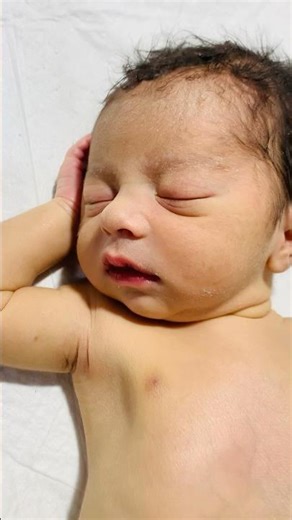 Premature Baby’s NICU Journey | A Tiny Fighter’s Story ❤️#baby #cute #viral #babyboy