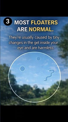 Seeing squiggly lines in your vision? Watch this