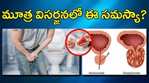 మూత్ర విసర్జన టైమ్​లో ఇలా అవుతోందా? - ప్రొస్టేట్ సమస్య కావొచ్చు - వెంటనే అలర్ట్ కాకపోతే అంతే! - Effects of Prostate Enlargement