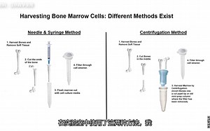 bone marrow stromal cells