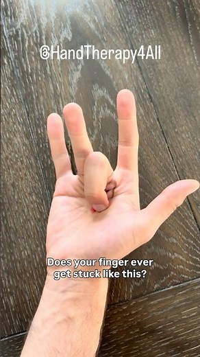 Does your finger ever get stuck? You might have a trigger finger!