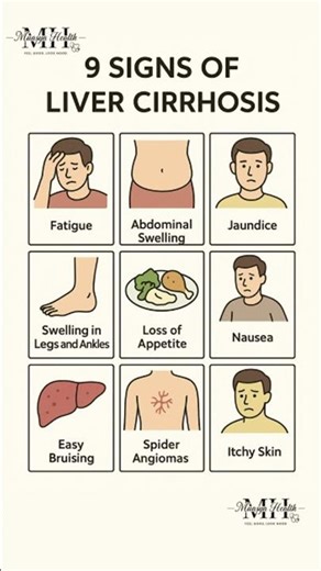 Signs of liver cirrhosis