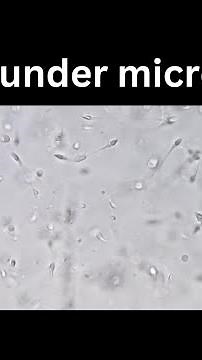 Sperm under microscope | Semen test | Spermatozoa | ‪@medicallabtechnologysajal6903‬
